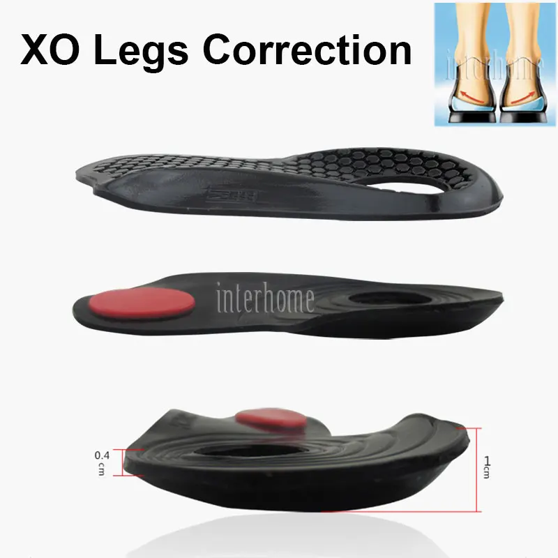 Original X/O type noge Ortopedije Silikonski Ortopedski Vložki Ravno Stopala Popravek Lepoto Noge, Oblikovanje Telesa Noge, Nego Čevlji Pad