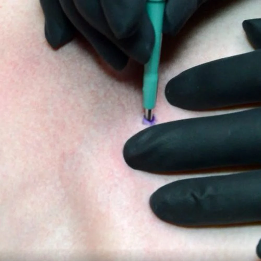 8PCS Mix Velikosti Sterilizirati za Enkratno uporabo Biopsije v stiku s kožo Luknjanje Za Kožo Orodje Piercing Enostavno Uporabo Strokovne Dermalno Piercing stroj