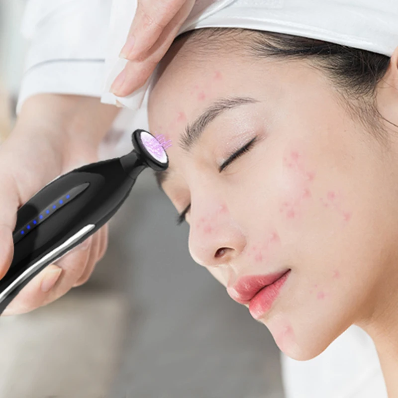 Lepota Instrument Plazme Akne Odstranitev Pero Kožo Obraza Lifting Zaostrovanje Lepotno Nego Kože Obraza Razstrupljanje Kože, Pomlajevanje