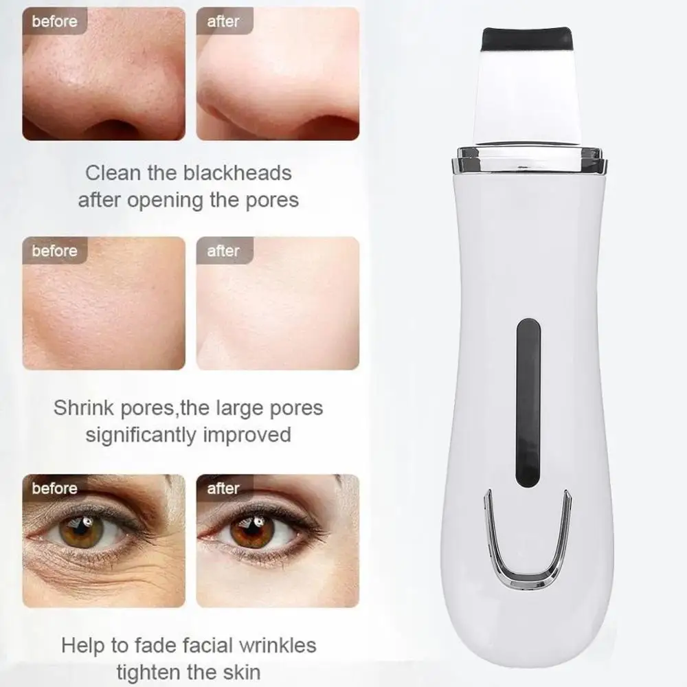 2020 Ultrazvočno Kože Scruber Globinsko Čiščenje Obraza Scruber Scruber Odstranitev Obraza Čiščenje Kože Strgalo Peeling Lepoto Opremite