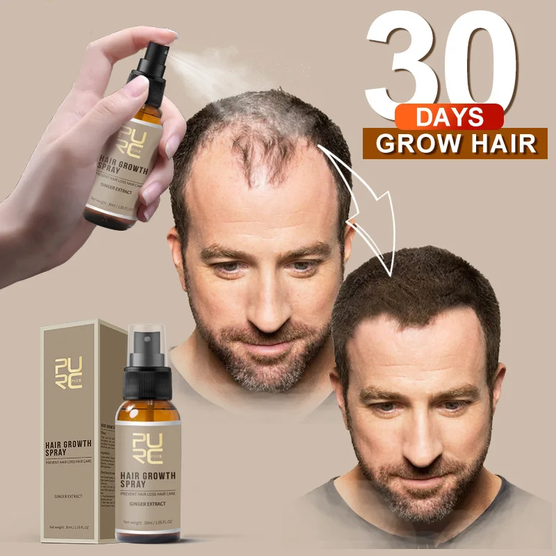 30 ml Čudež Rasti Dlak Spray Hitro 30Days Rastejo Obnovo Krepitev Las Zdravljenja Anti Hair Loss Preprečiti Ćelavost TSLM2